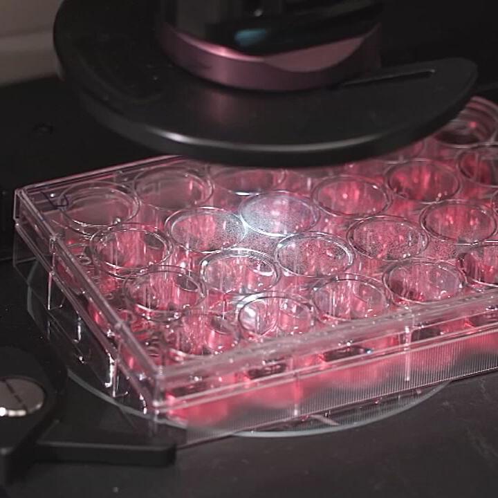 U OF L CO-IMMUNITY RESEARCH - COVID-19 FILE  (2).jpg